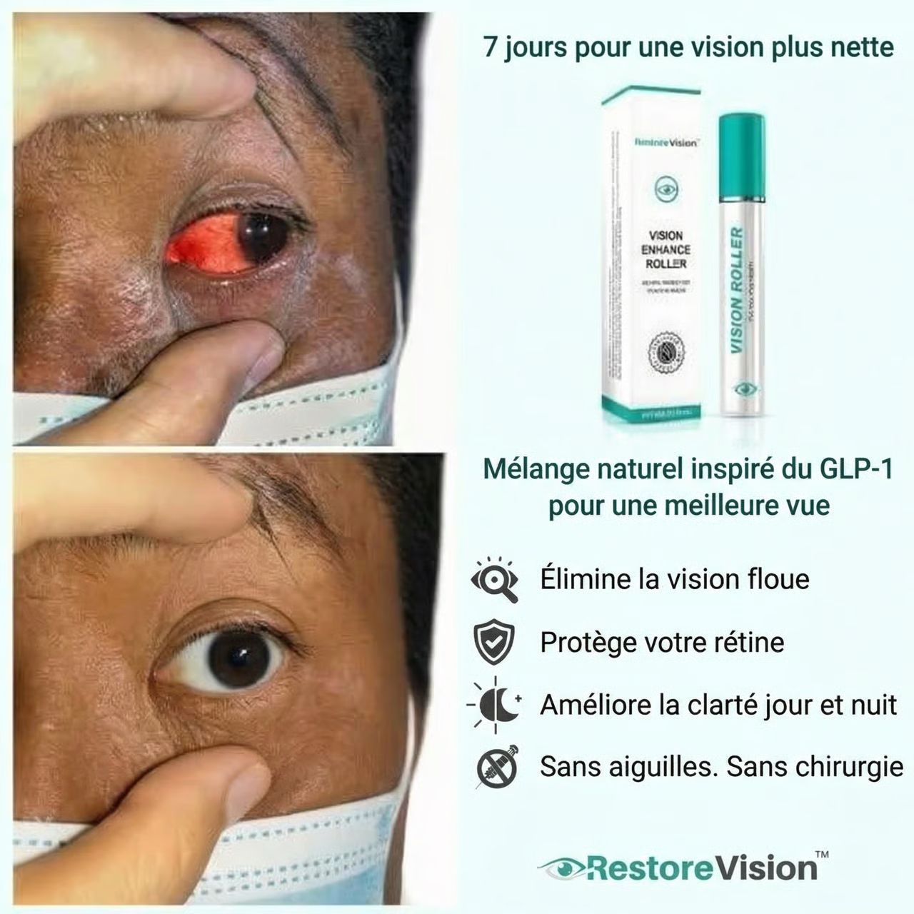 VISON ENHANCE ROLLER