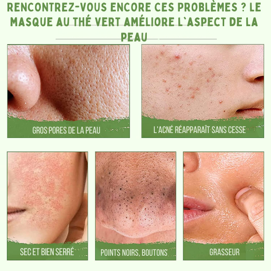 Tu te laves le visage tous les jours… mais tes points noirs refusent de disparaître ?