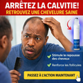 Sérum roll-on pour la croissance des cheveux