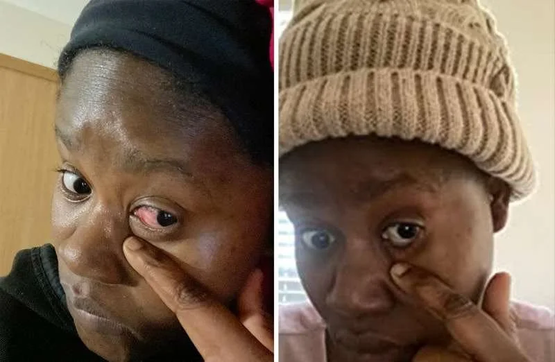 😔 Et si la fatigue de vos yeux devenait pire avec le temps… ?