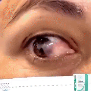 👀 Vos yeux vous envoient peut-être déjà des signes de fatigue…